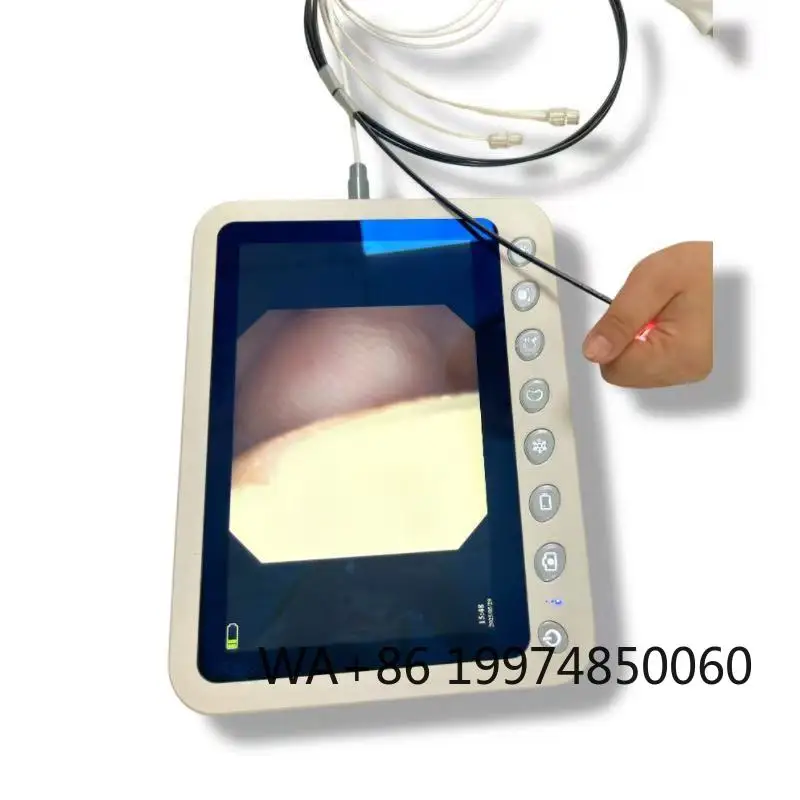 

All-in-One Veterinary Monitoring Machine 720p Camera Processor Connects Bronchoscope Uroscope Choledochoscope Cystoscope