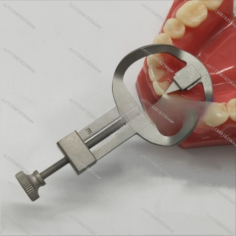 For Dental Separator Orthodontic Temporary Separator Dental Space Separator Post-dental Department Oral Care