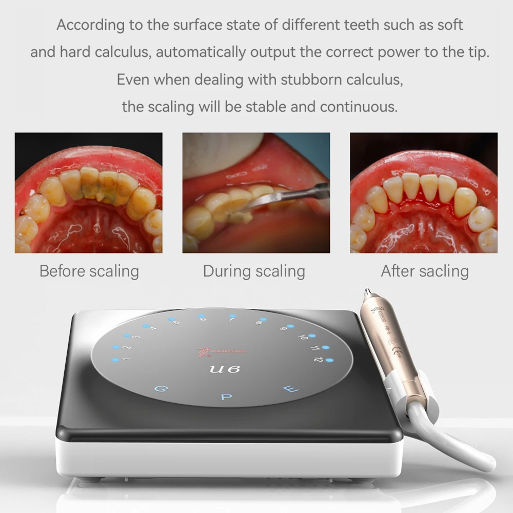 Dzięcioł U6 dentystyczny skaler ultrasonograficzny wygodny skalujący inteligentny System dotykowy wysokiej jakości rękojeœæ potężna funkcja