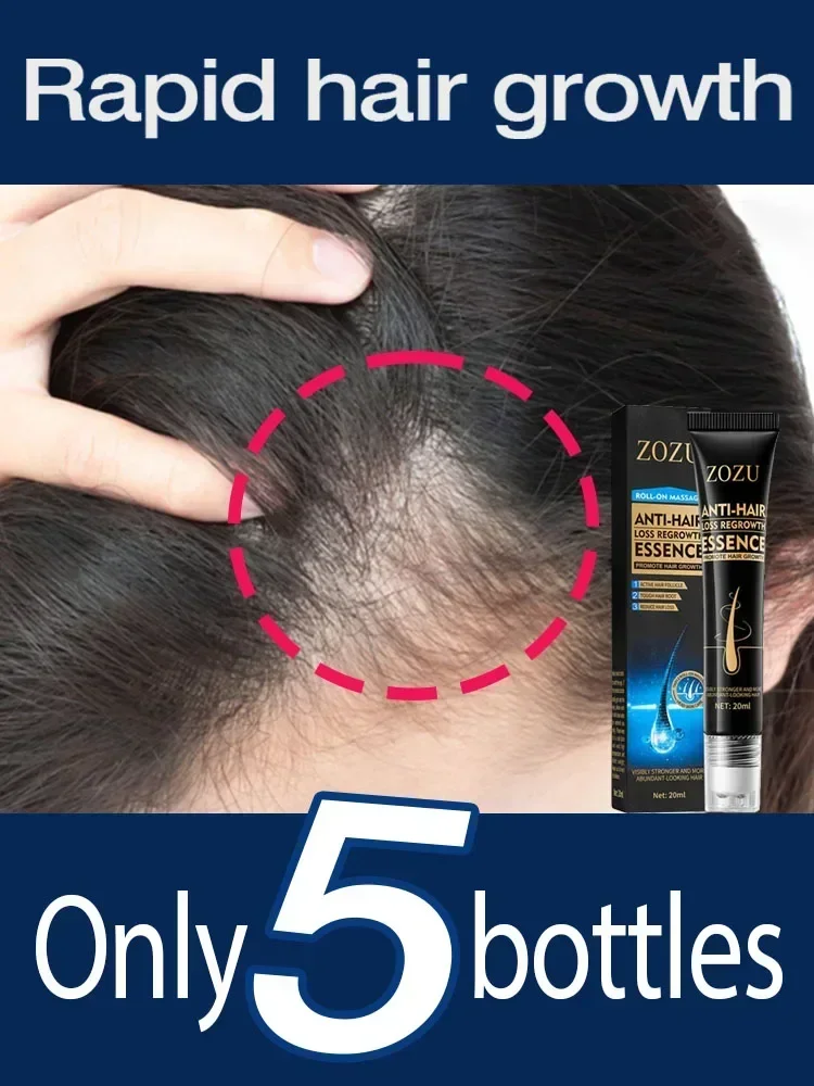 

Fast Hair Growth Essence Effective Anti Hair Loss Serum Baldness Repair Hereditary Postpartum