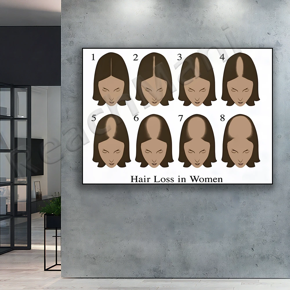 Female hair loss chart sign, hair loss reference infographic poster, girl bedroom decor for beauty salon home store