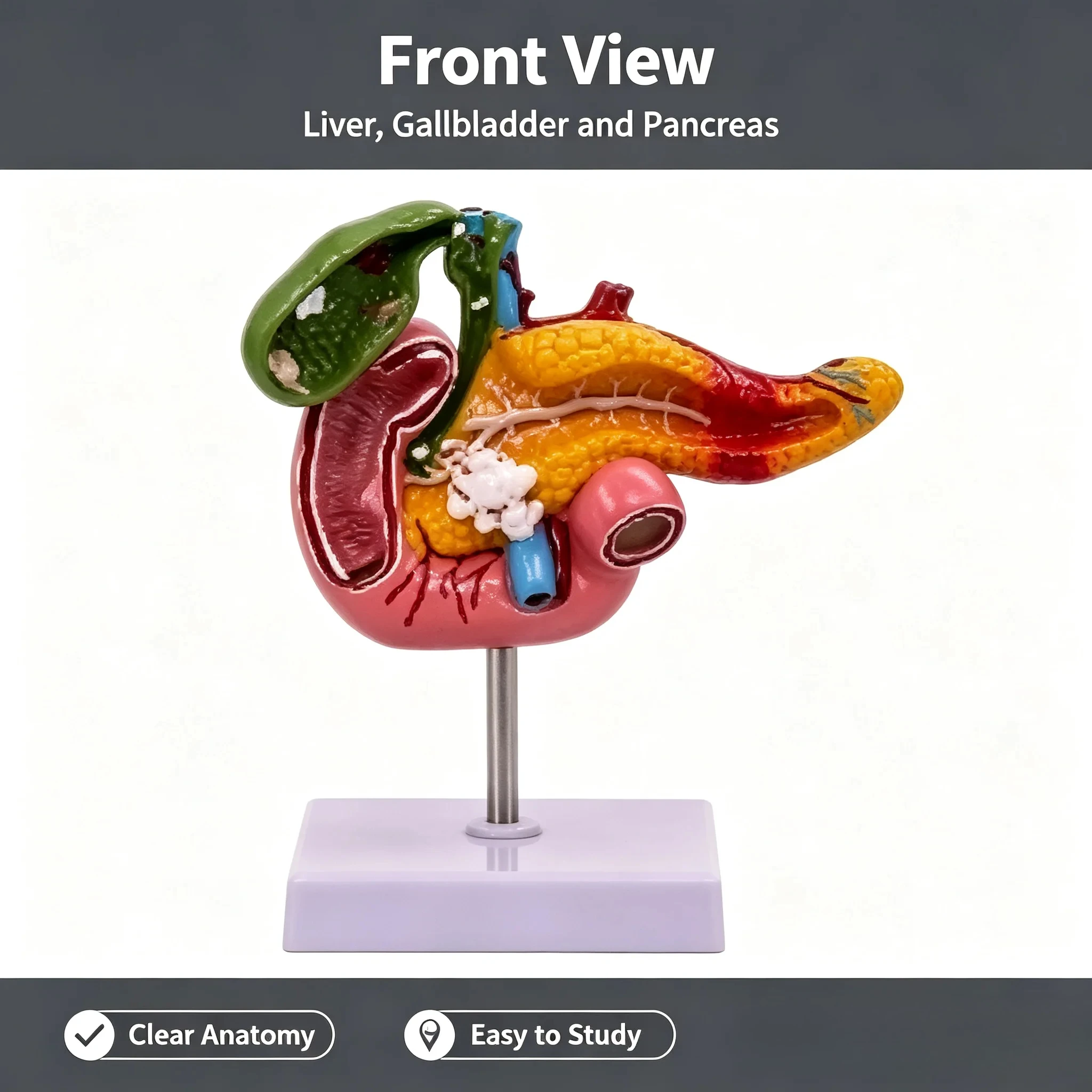Teaching Simulation Human Pancreas Duodenal Gallbladder Pathological Model Gallstone Surgery Digestive System Teaching Aids