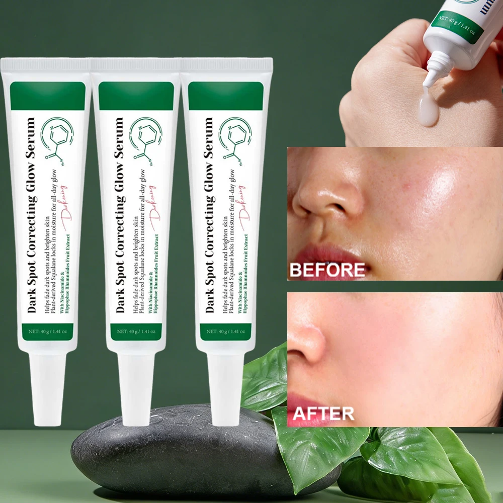 

Dark Spot Correcting Glow Serum 5% Niacinamide Dark Spot Remover Korean Skin Care Serum for Women, Brighten Skin Tone,40g