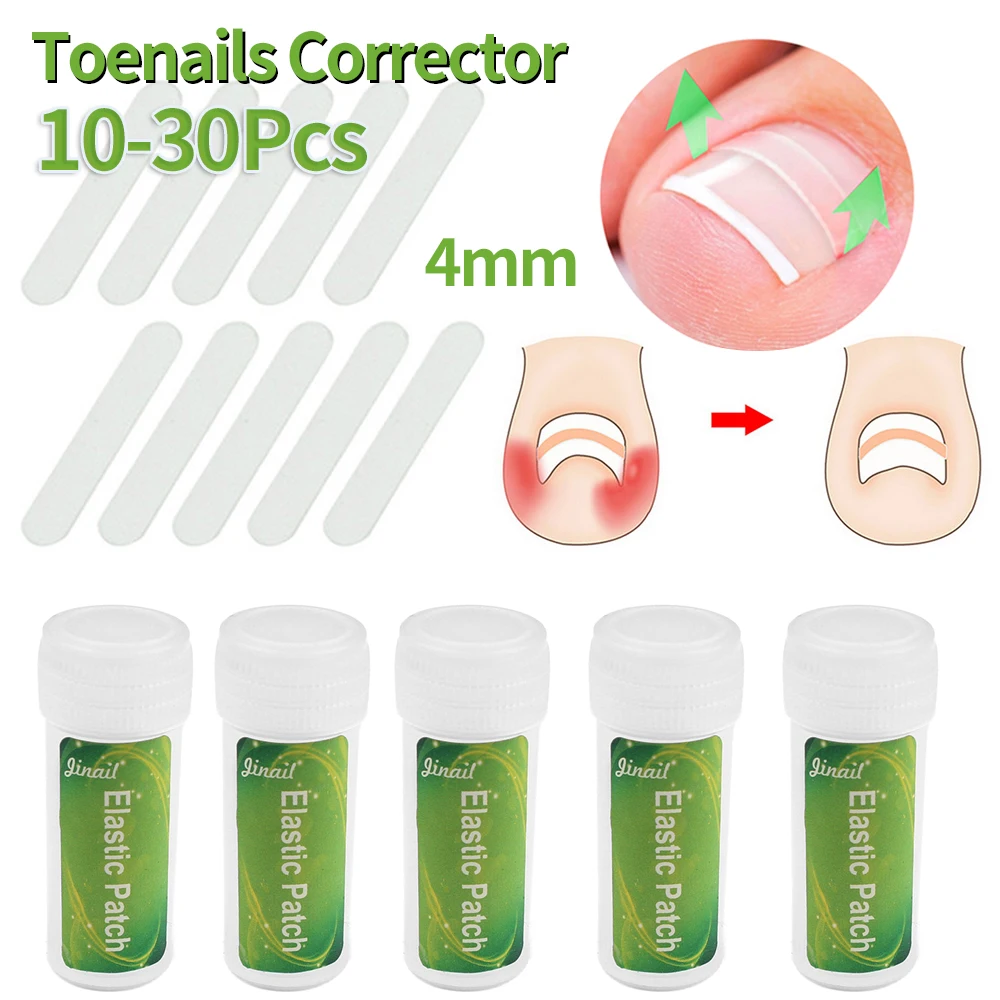 

100-300Pcs Ingrown Toenail Corrector Straightening Clip Pedicure Foot Nail Care Tools Pedicure Treatment Correction Tool