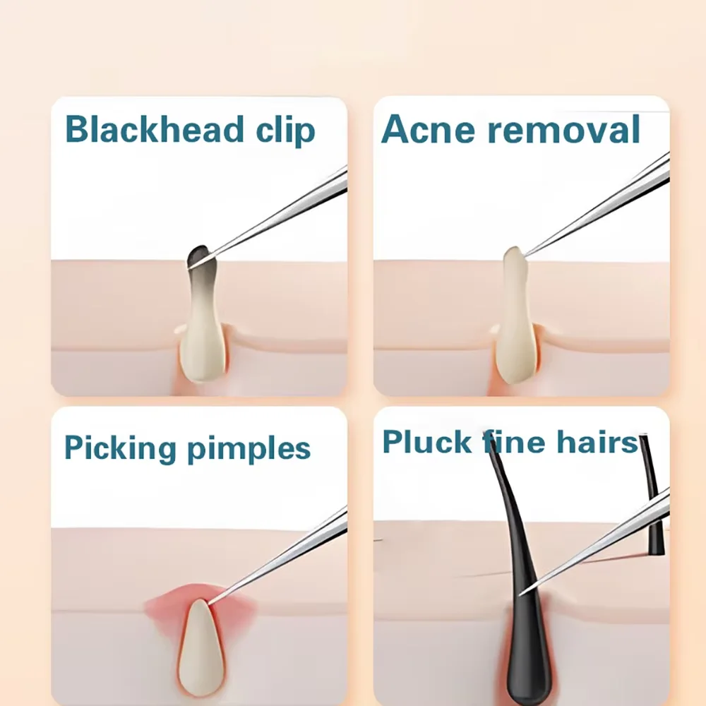 Zestaw igieł do usuwania zaskórników i pryszczy 3/4/8 szt. Igły do usuwania czarnych kropek, wyprysków i niedoskonałości, narzędzie do głębokiego oczyszczania skóry twarzy, stal nierdzewna
