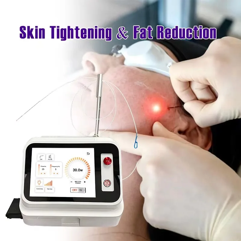 1470nm Endo Facelifting Laser Lipolysis Machine, Skin Tightening & Facial Fiber Lift | 980nm Endolaser Liposuction for Body