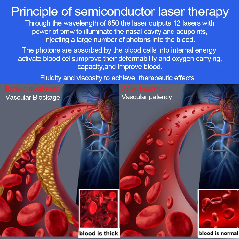 15 Holes 650nm Laser Therapy Watch Diode LLLT Wrist Watch For Diabetes Cholesterol Hypertension Treatment Sinusitis Therapy