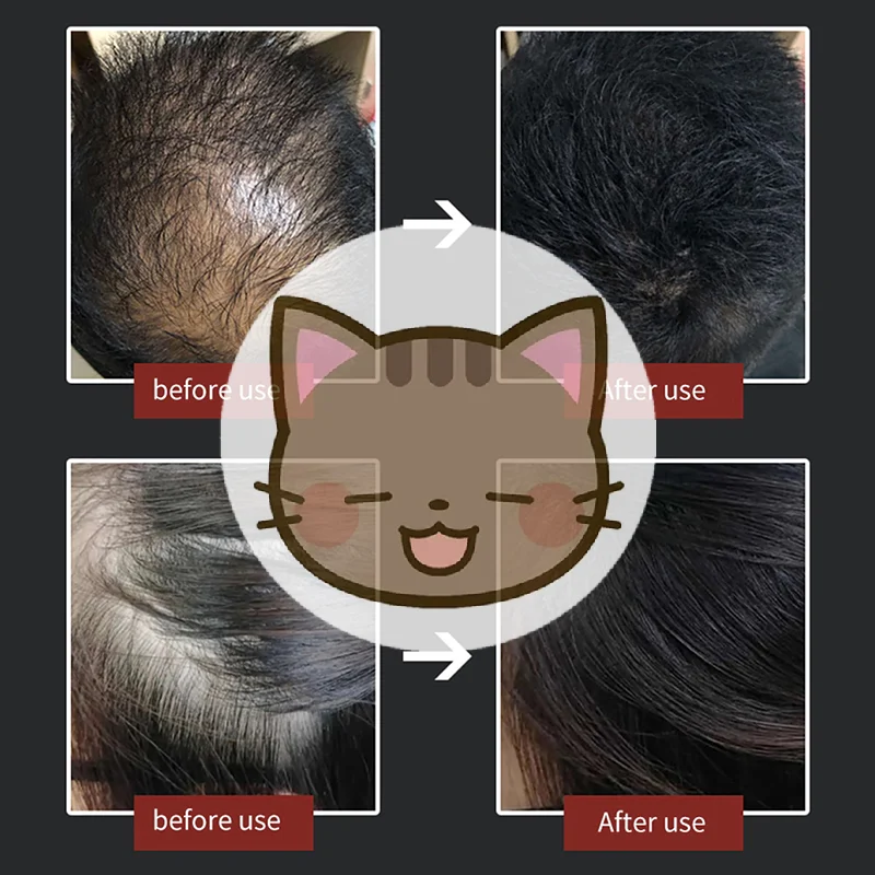 

Hair Fibers Powder Special Comb Hair Loss Building Fibers Hair Line Optimizer Hair Thickening Fibers