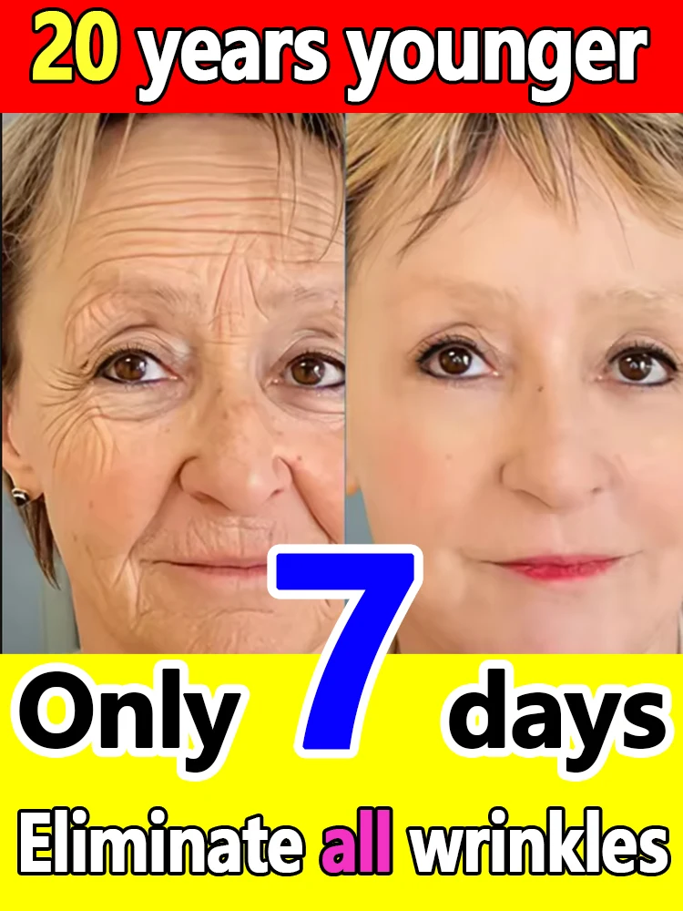 

No wrinkles, 20 years younger