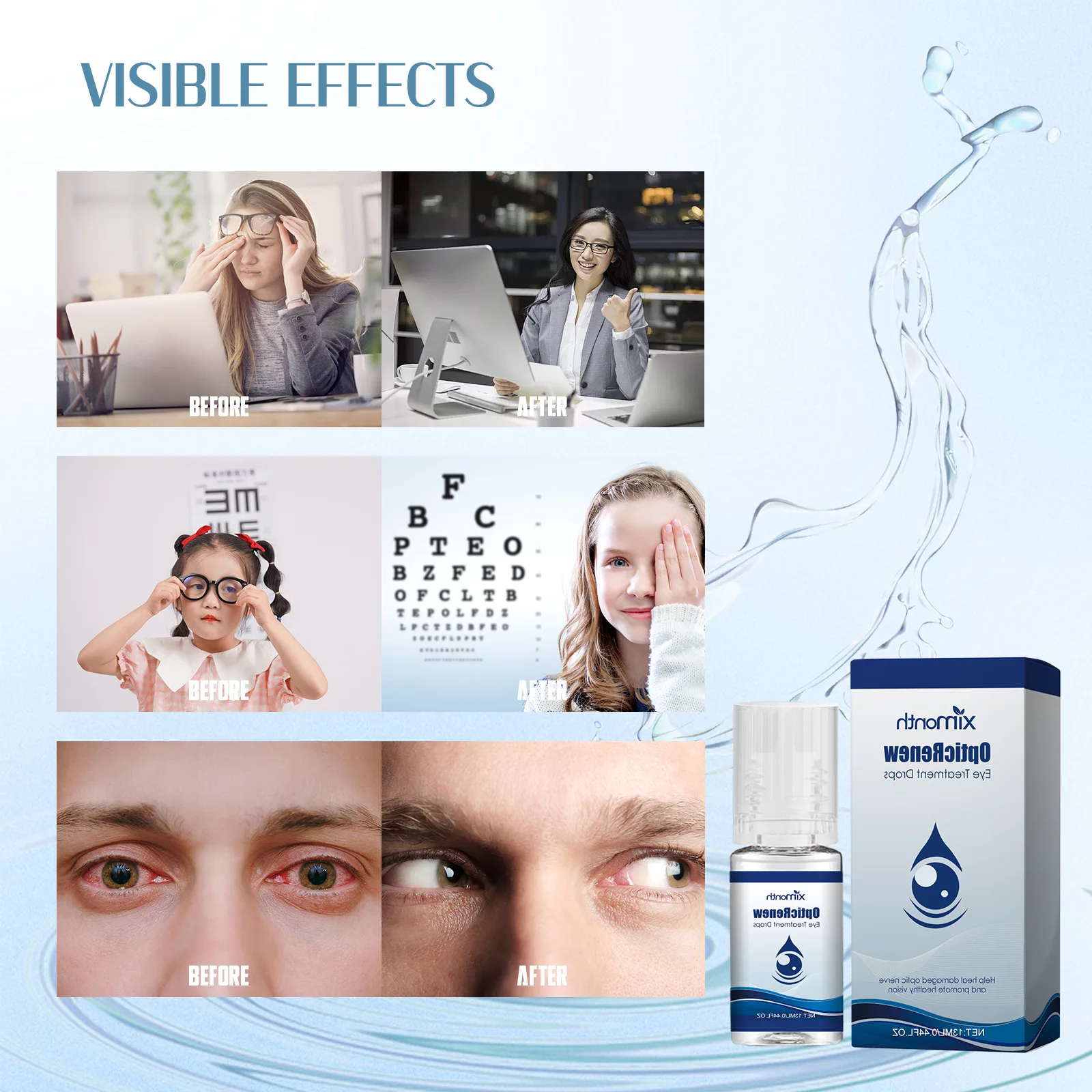 Cataract Treatment Eye Drops Soothing Blurred Vision Eye Redness Itching Drying Myopia Astigmatism Removal Presbyopia Eye Drops