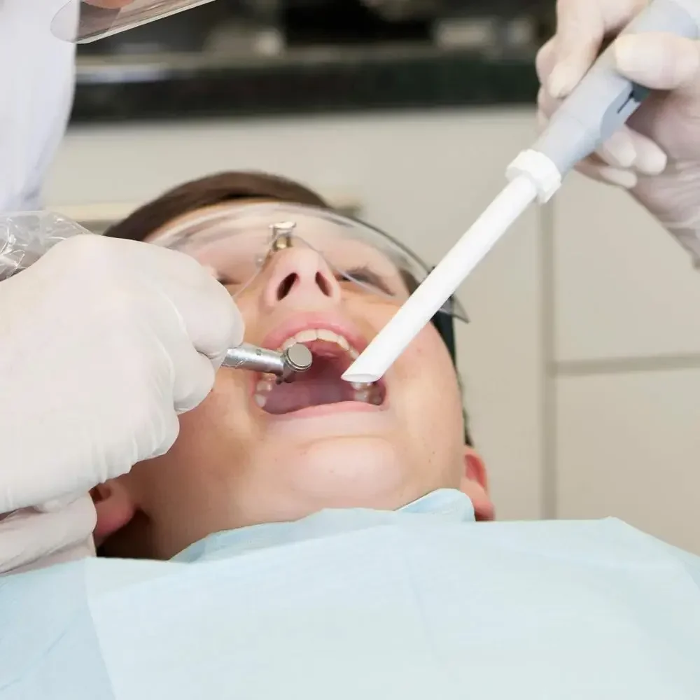 

300Pcs Disposable Hve High Volume Suction Vented Dental Evacuation Tips Dental Tools Dentisty