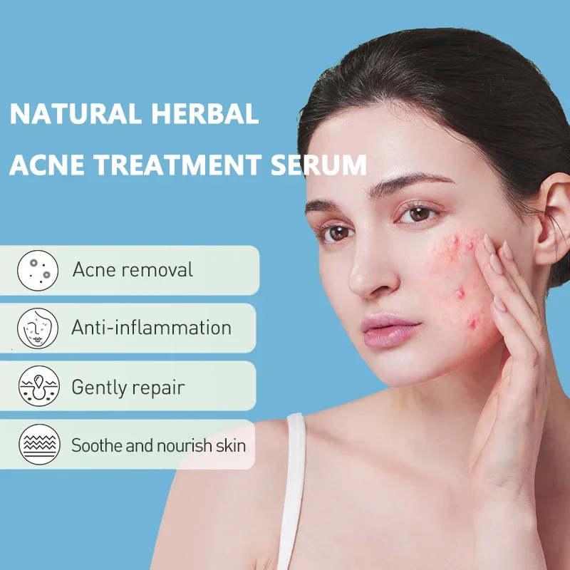 

Salicylic Acid Solution Essence Fades Acne Spots Shrink pore and Acne Spot Removing Shrink Pores Oil-Control Brighten Face Skin