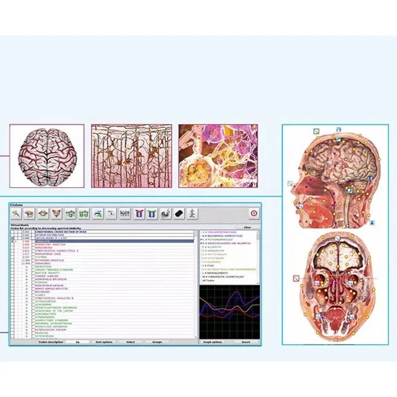 Il più nuovo analizzatore di salute del corpo 25d 9d Quantum Biofeedback Magnetic Metatron Nls 4025 Resonance