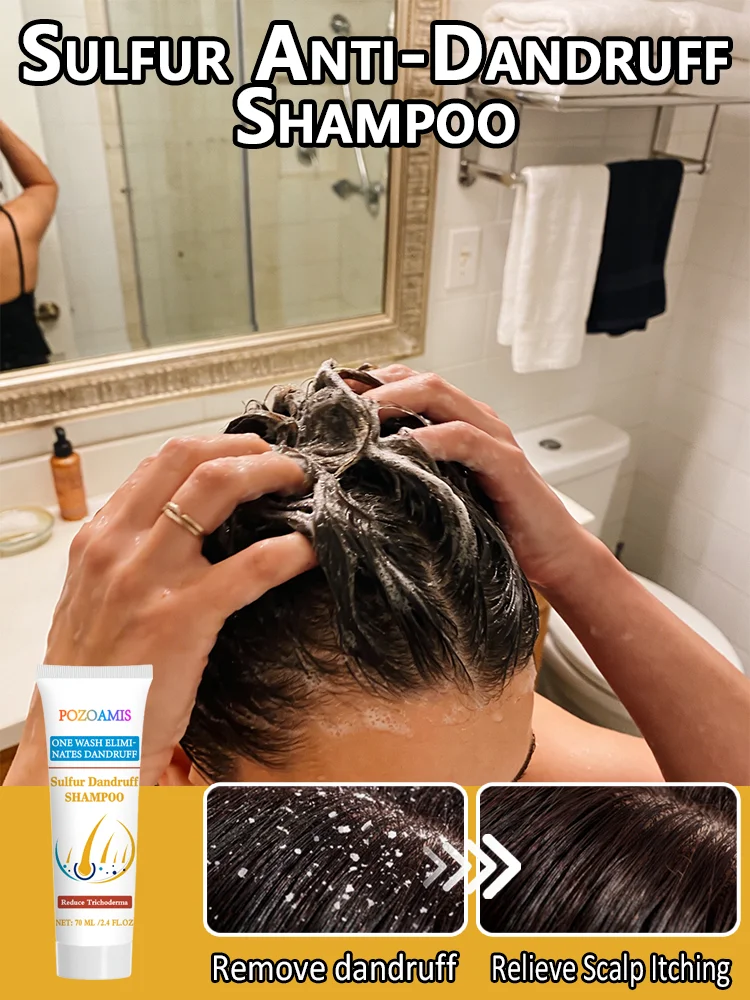 

Sulfur Anti-Dandruff Shampoo Anti-Itch Oil Control Deep Cleansing Scalp Care Shampoo for Men Women Daily Use