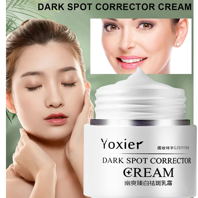 Powerful Whiten Freckle Cream Fast Remove Melasma Melanin Correcter Anti-Pigmentation Dark Spot Fade Improve Dullness Skin Care