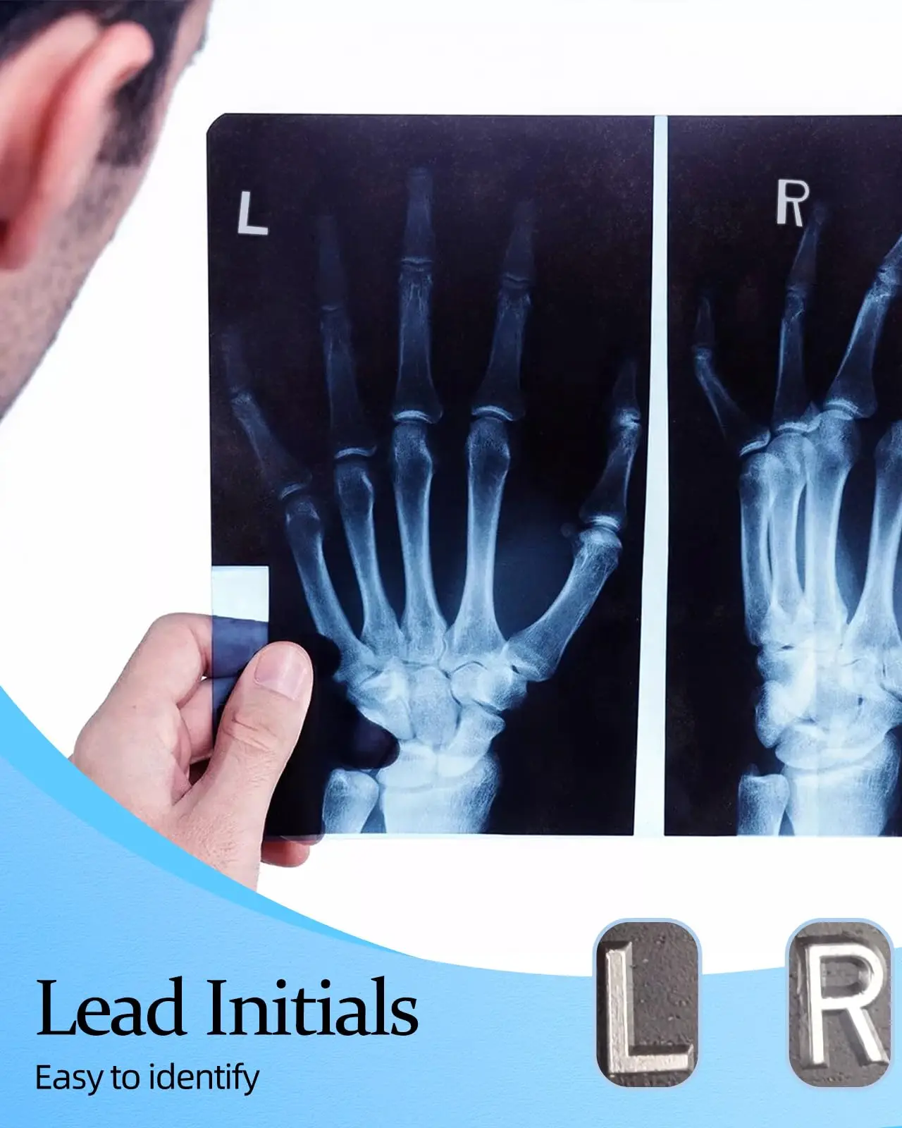 

X-Ray Markers Glitter Resin Reusable Adhesive Tapes To Nurse Radiologist Badge Reel Easy To Identify Letter L & R Marker