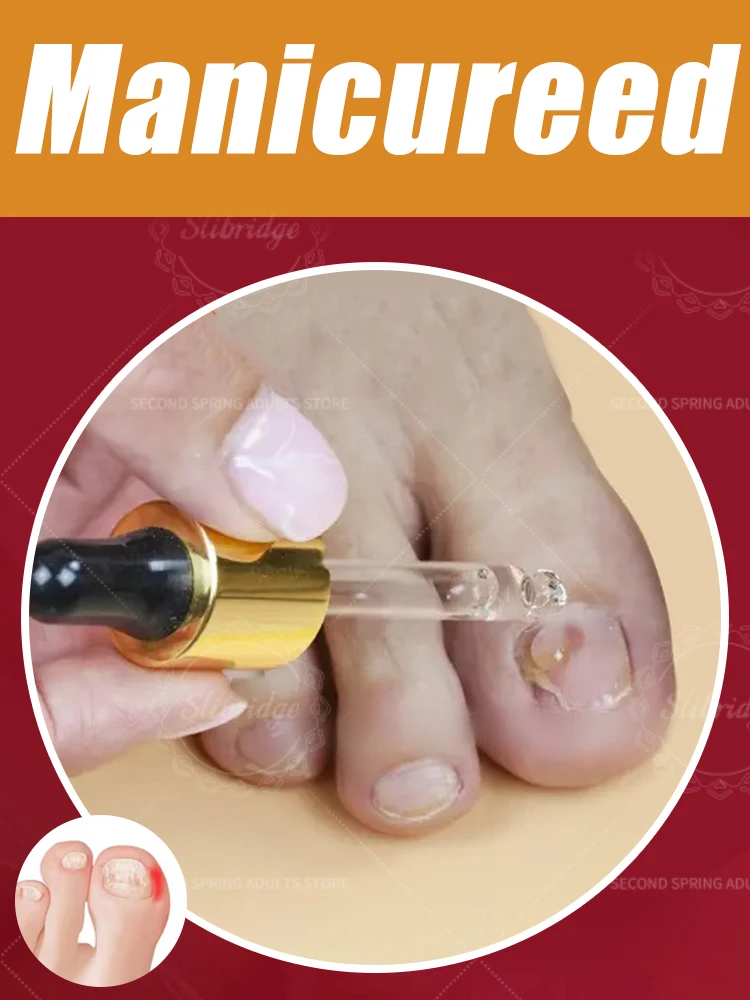 2025年、真菌を迅速に除去し、健康な爪を取り戻します