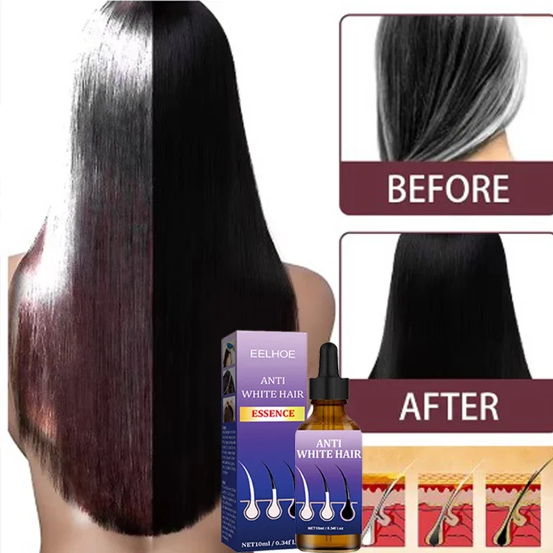 Assassino de cabelo branco, remove cabelos grisalhos e restaura a cor natural do cabelo em 7 dias Saudável, transforma rapidamente o airh branco em preto