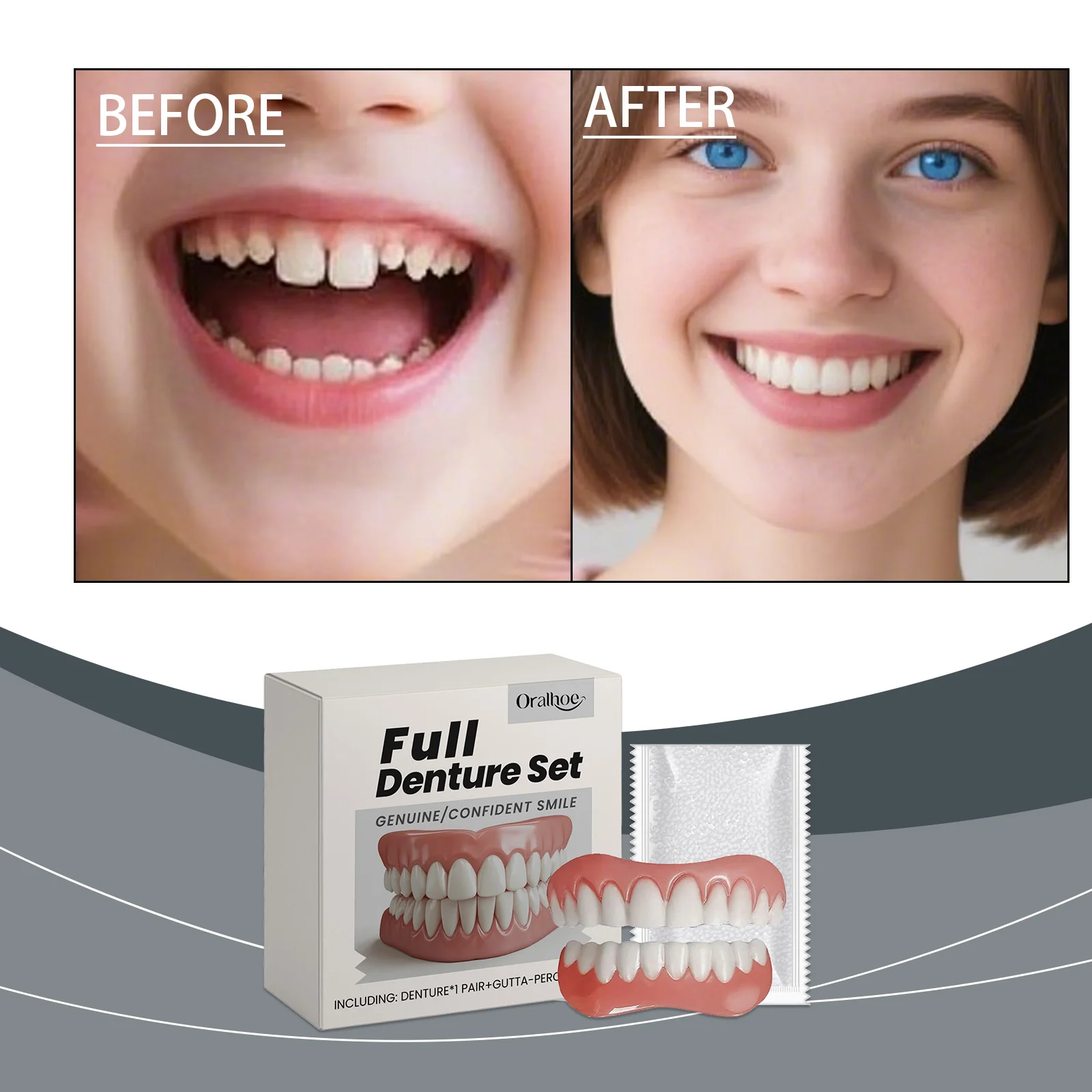 Oralhoe Dental Prosthetic Enhancement Kit for Enhanced Smile Aesthetics and Comfort with Cosmetic Denture Materials
