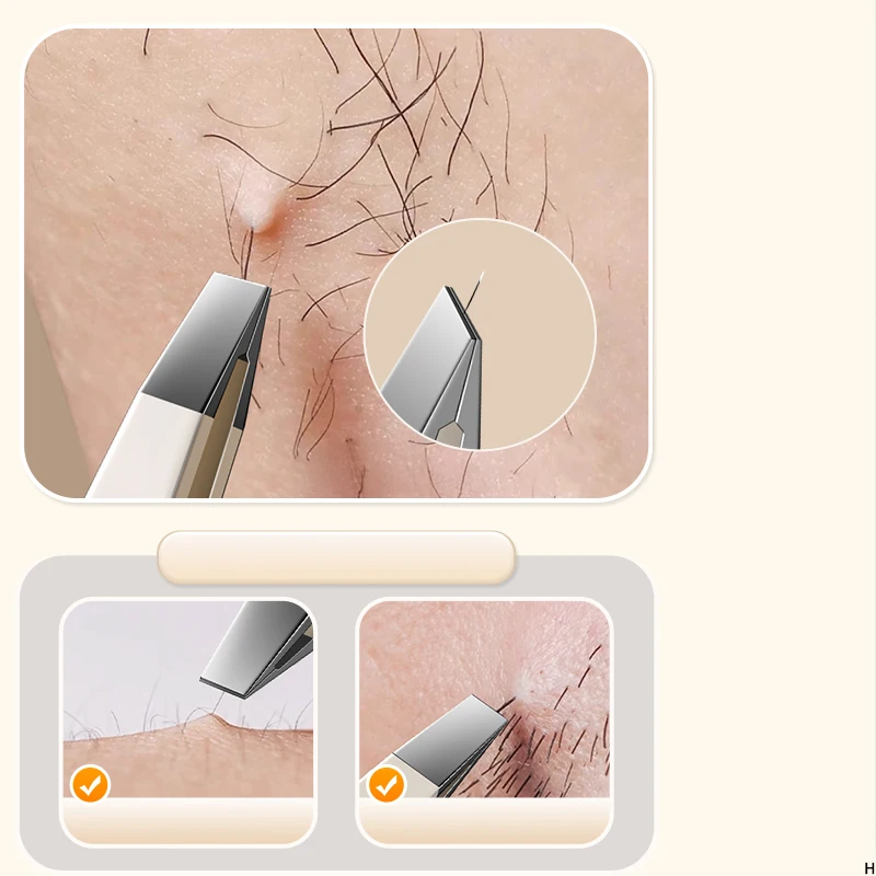 แหนบ, ที่หนีบคิ้วขนาดเล็ก, คีม, ที่หนีบคิ้วสแตนเลส, คลิปพิเศษสำหรับกำจัดขน, เครื่องมือกำจัดเคราสำหรับผู้ชาย