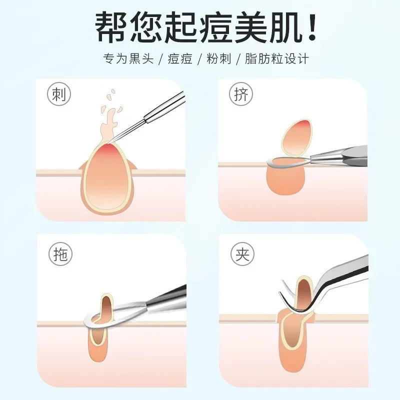 4pcs/set Blackhead Remover Acne Blackhead Vacuum Comedone Blemish Extractor Pimple Needles Removal Tool Spoon For Face