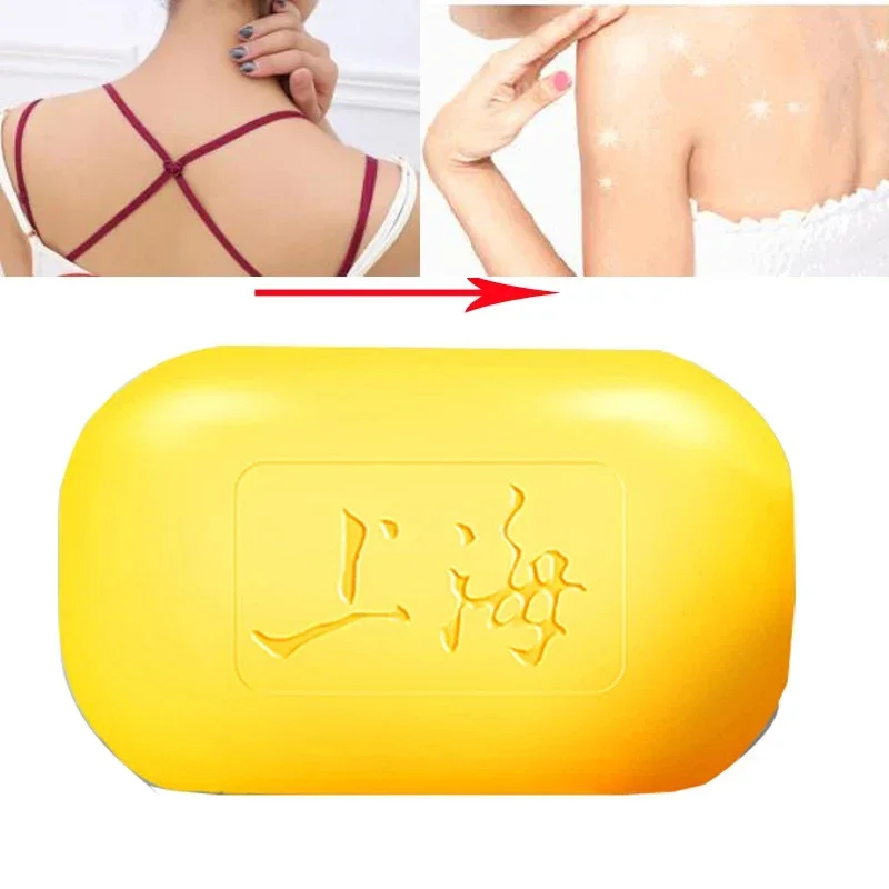 Рисунок 5 - Шанхай серное мыло для жирной кожи