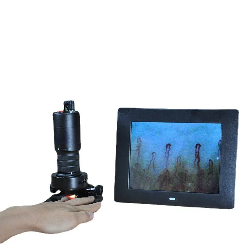 

Hot SalesImported Chimao DMX980-1 Bl,ood Microcirculation Tester