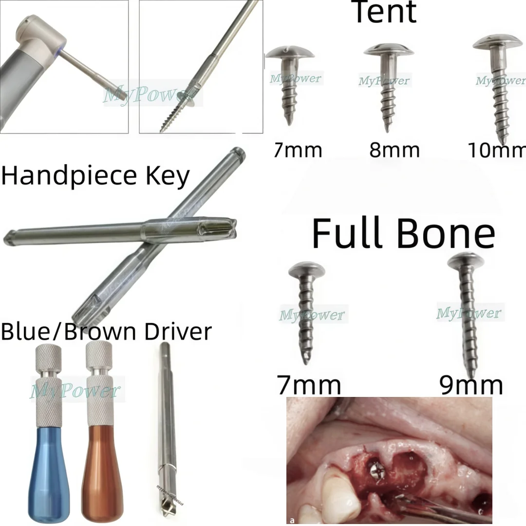 Dental Bone Fixation Screw GBR Tent Screws Full/Half Thread TC4 Self Drilling Tenting Screw Driver Tools