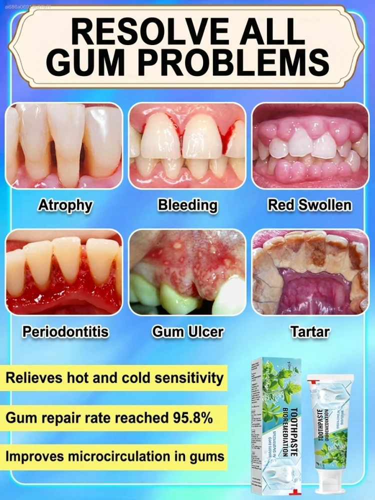 Intensive Probiotic Gum Treatm - đánh giá và giá Teeth Whitening Paste