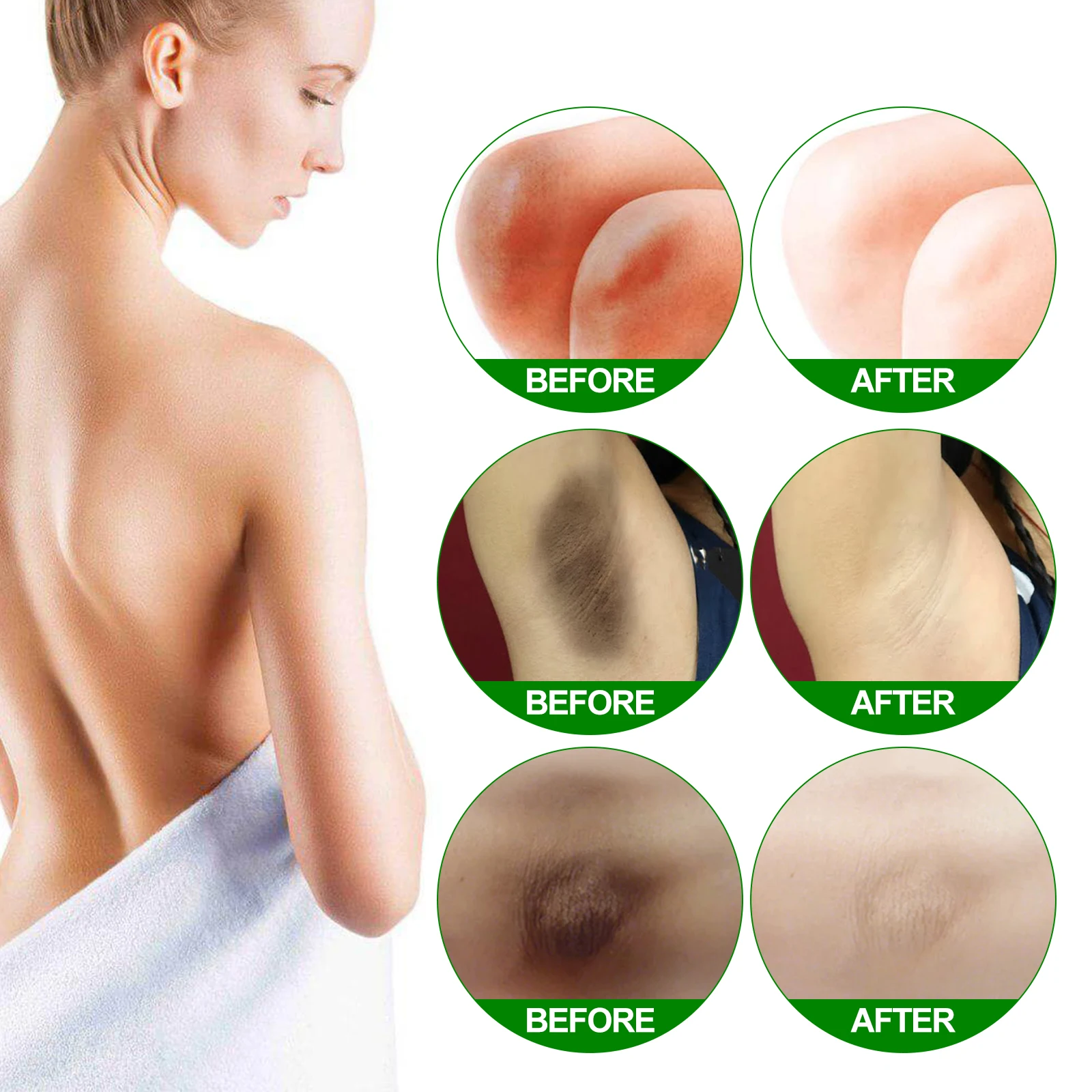 EELHOE Retinol Whitening Cream Private Part Armpit Knee Buttocks Moisturizer Dark Skin Bleaching Lighten Melanin Brighten Cream