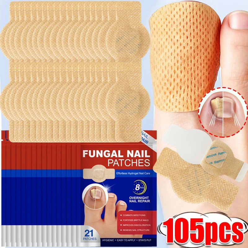 105/21pcs Nail Repair Patches Toenail Fungus Patch Care Nail Inlay Correction Sticker Paronychia Disposable Toenail Patches