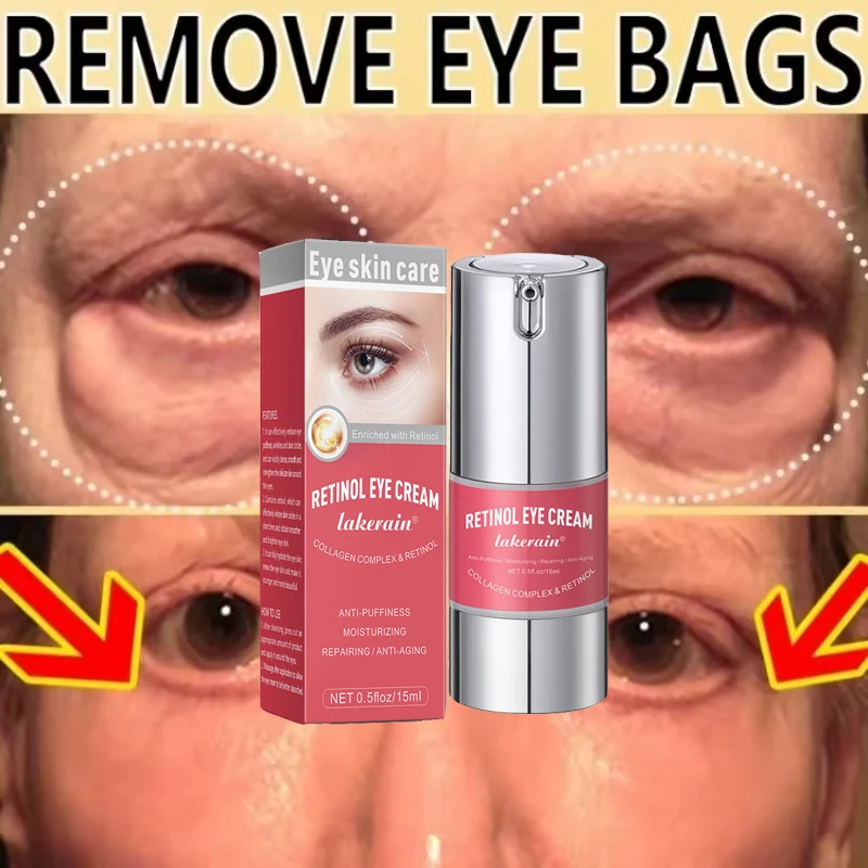 

Instant Eye Bag Removal Cream Retinol Anti-Wrinkle Lifting Firming Fade Fine Lines Removing Eye Bags Make Your Eyes More Lively