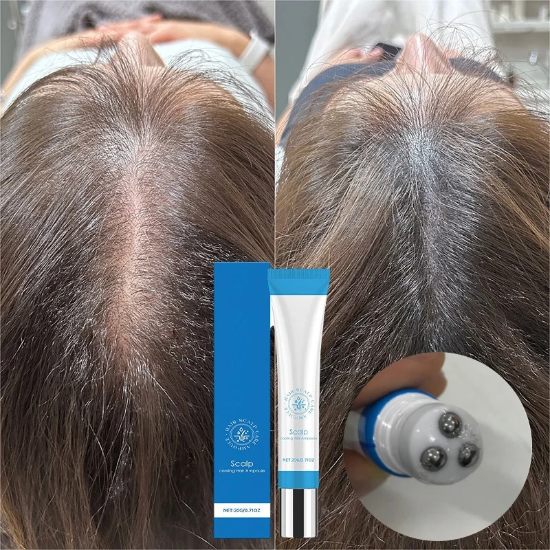 

Scalpy Сыворотка для волос Сильный питательный уход за волосами Шариковый массаж кожи головы для улучшения роста волос Эссенция для кожи головы Охлаждающая ампула для волос