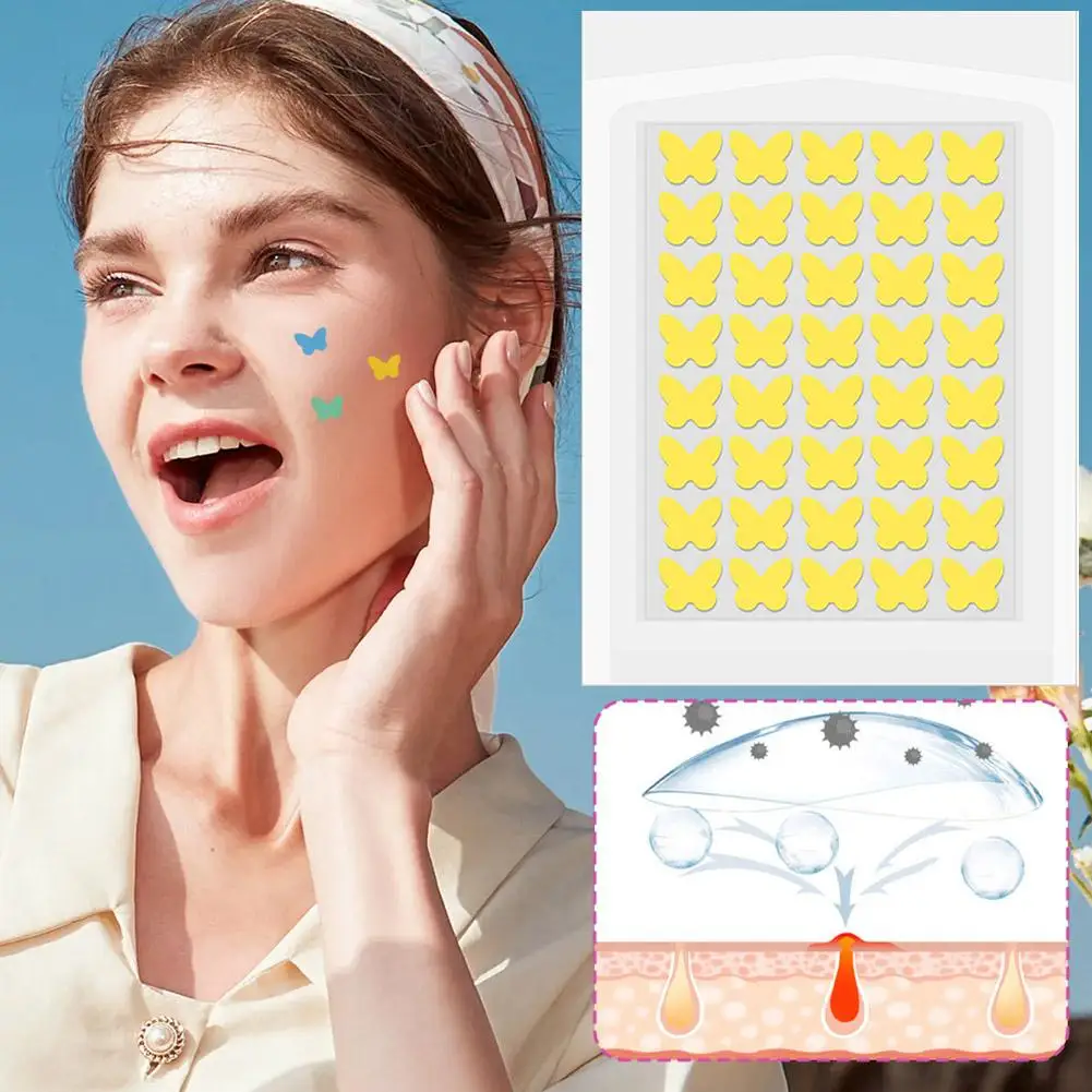 Patchs hydrocolloïdes pour boutons d'acné, pour le visage, estompe les imperfections, marques de boutons, imperfections d'acné fermées, couverture en forme de papillon