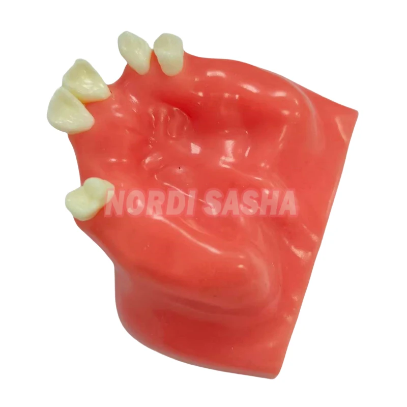 Dental Implant Teaching Model Maxillary Mandibular Sinus Model Soft Gums Teeth Model For Dentist Practice Studying Tools