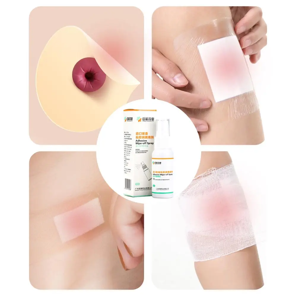 

30ml Colostomy Adhesive Wipe-off Spray Medical Stoma Ostomy Remover Chassis Bag Care Stripping Products Adhesive Spray K0n7