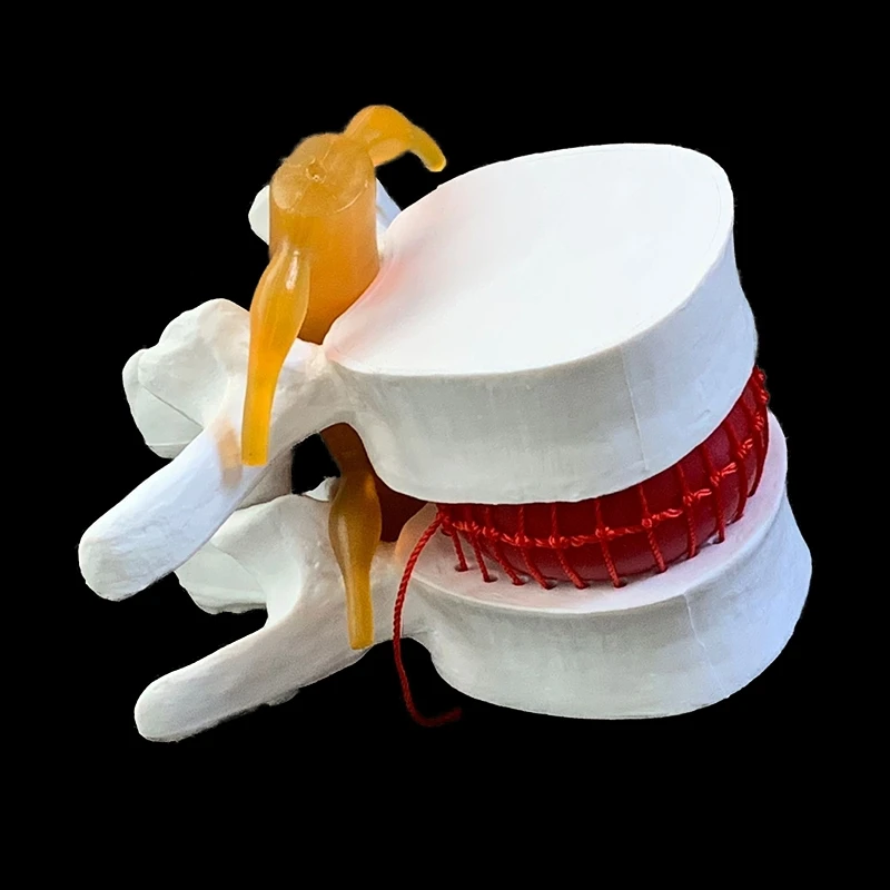 Spine Human Spine Model Full Size Demonstration Model Of Human Lumbar Intervertebral Disc Compression For Medical Teaching