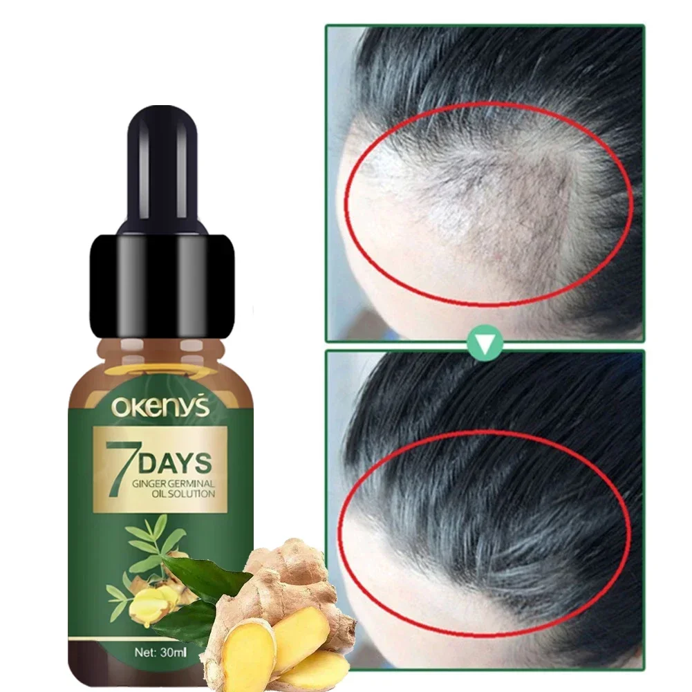 Ginger Hair Growth Essence 7 Days Germinal Hair Growth Serum Essence Oil Hair Loss Treatment Growth  for Men Women