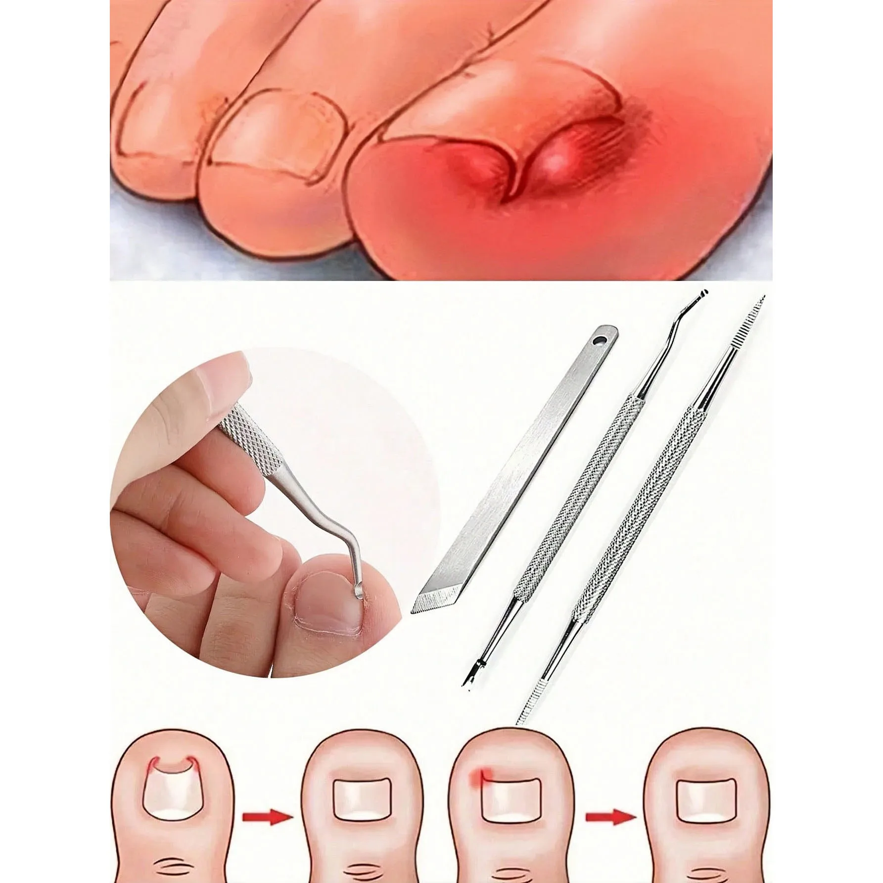 4Pcs/Set Stainless Steel Toenail Trim Kit, Foot Scraper Foot Nail Care Double Sided Pedicure Nail File, Callus Remover For Clean