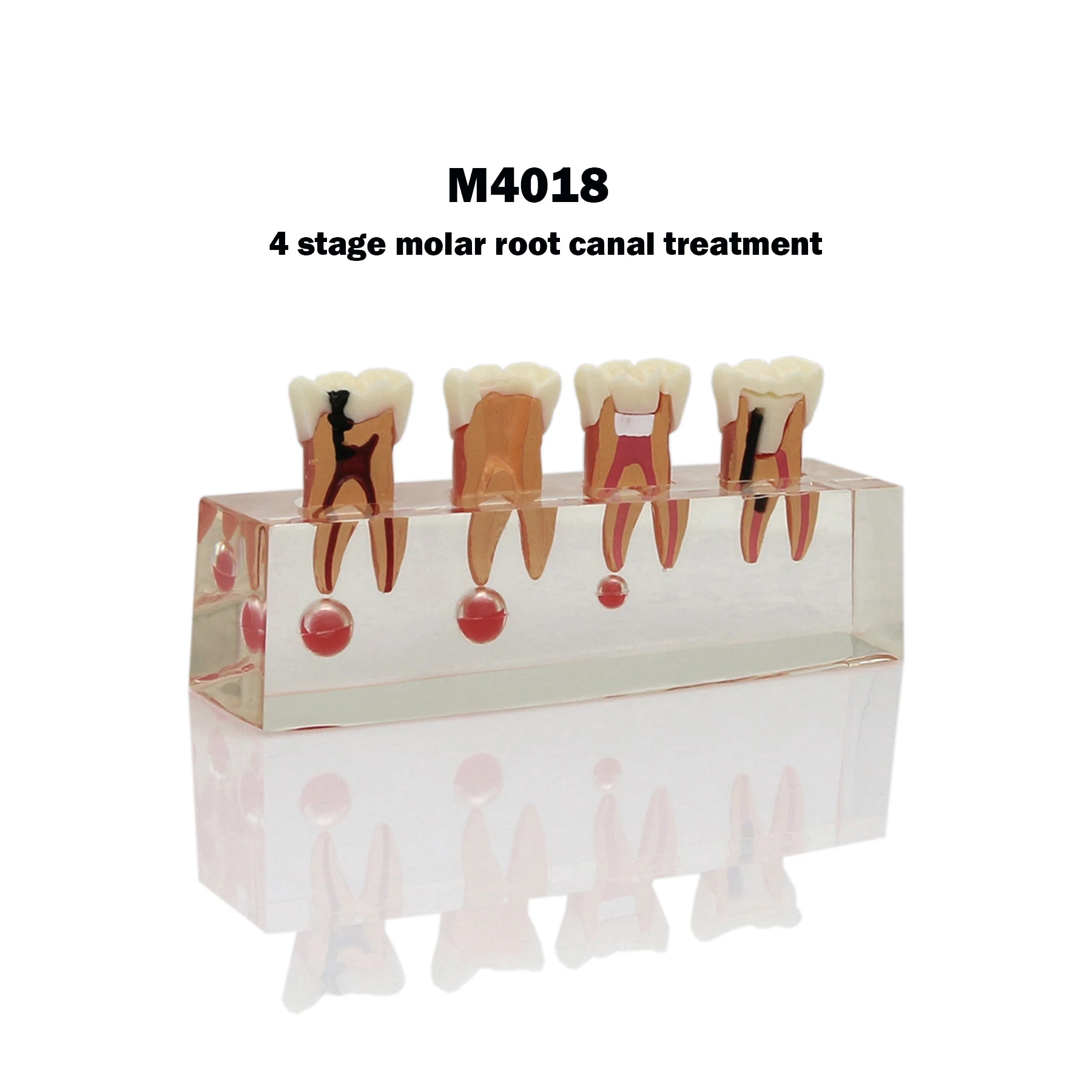 Dental Pathological Teeth Model 4 Stages Endodontic Treatment Assort For Patients Molar Root Canal X-ray Image Demo M4018