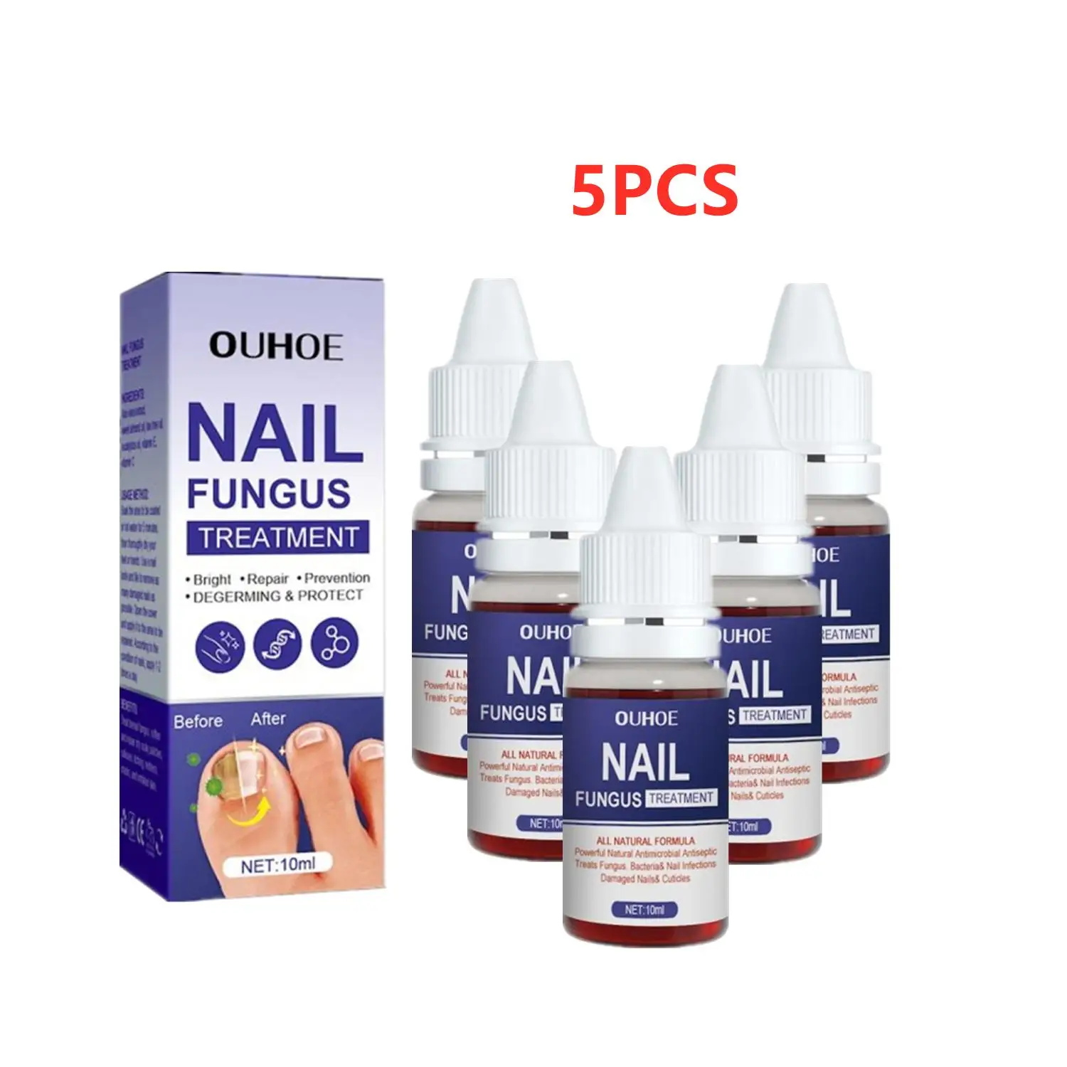 5PCS Nail Fungal Treatment Feet Care Essence Anti Infection Paronychia Toe Fungus Repair Nail Fungal Serum Removal Onychomy