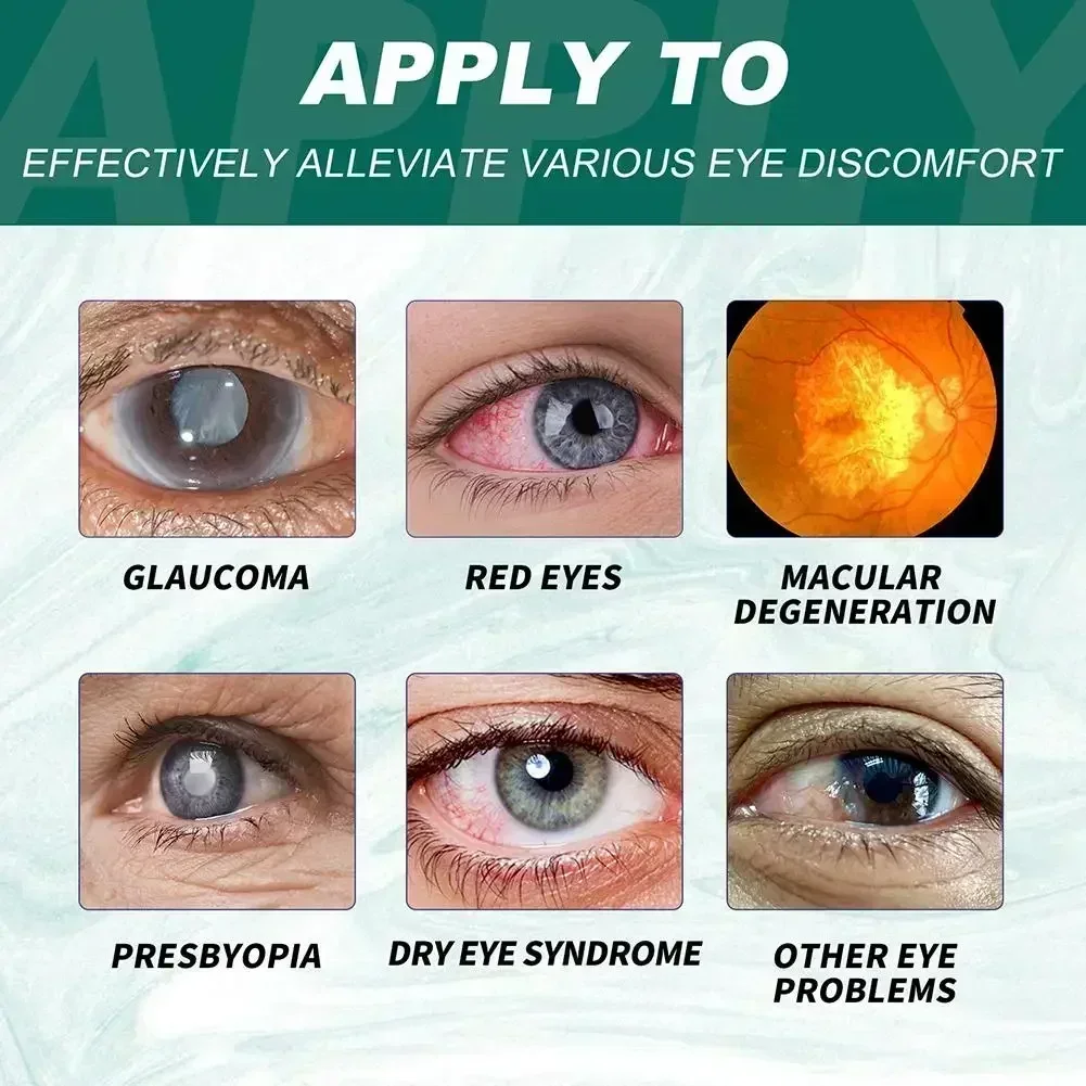 Eye Drops Relieves Eyes Discomfort Blurred Eyes Sore Eye Care Itchy Relax Dry Swelling Massage Clean