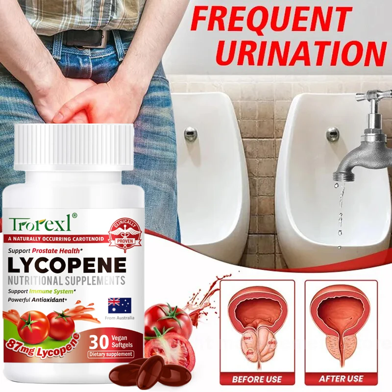 Trorexl Lycopene Capsules Natural Supplements Support Immunity System & Prostate Health