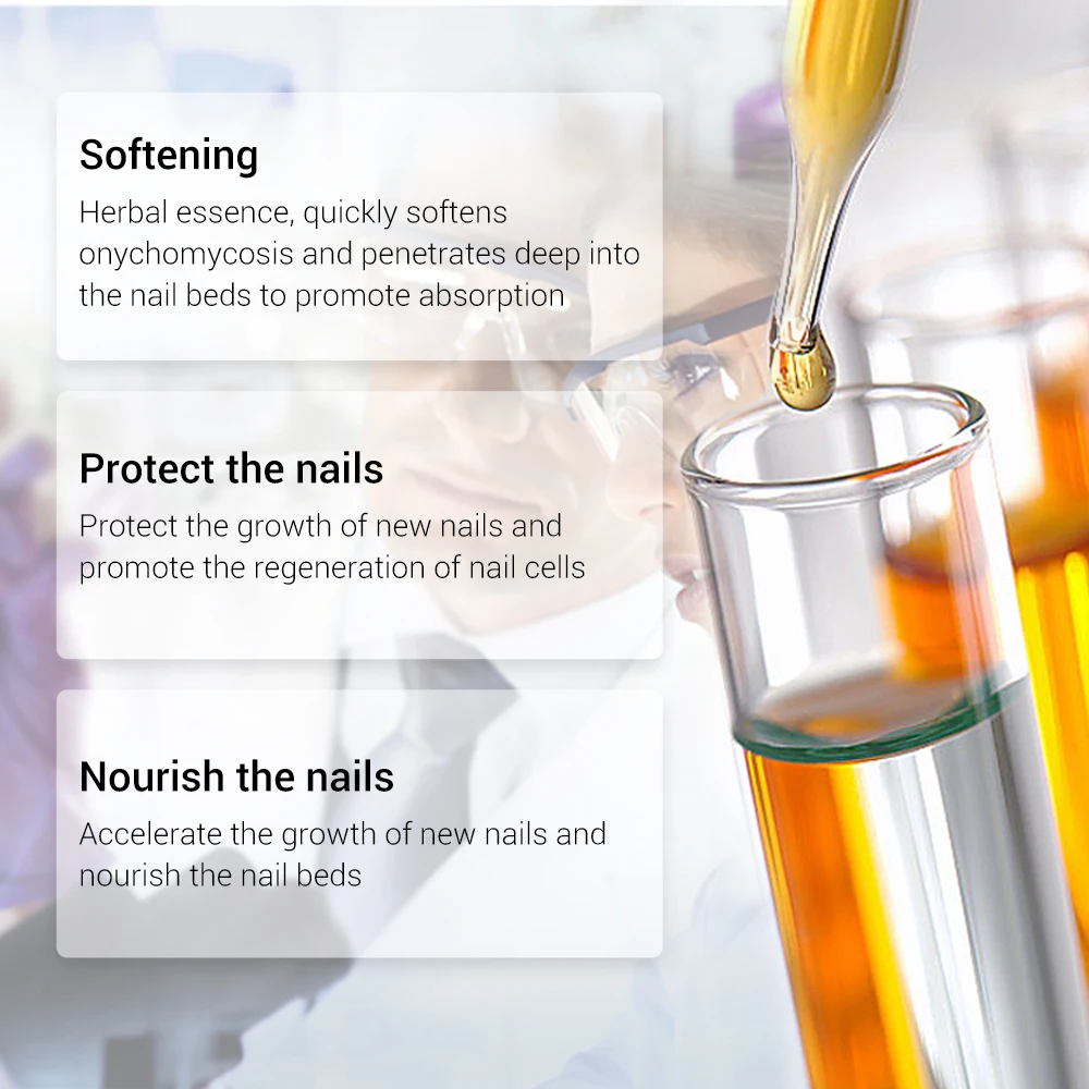真菌ケア爪真菌症のつま先を除去栄養明るく手足製品修理適切な女性の爪ペペアエッセンス 15 ミリリットル
