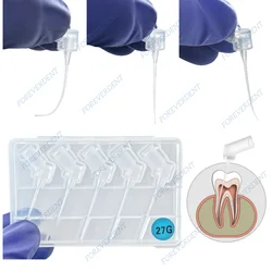 100pcs Dental 27GA Root Canal PD Irrigation Flexible Irrigator Tips IrriFlex Style Double Side Hole Opening Flushing