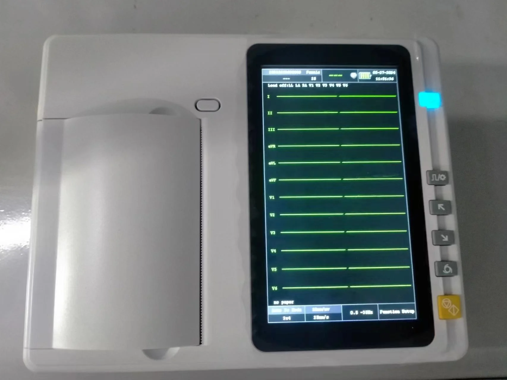 Digital Portable ECG 12 Channel Lead ECG EKG Machine Electrocardiograph Ecg Device