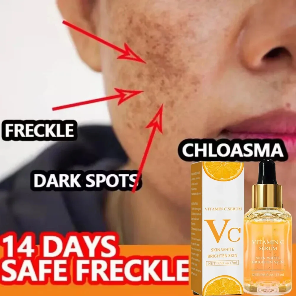 Vitamin C Remove Shade Serum Brighten Freckles Fade Melanin Retinol Weaken wrinkle Essence Brightening Korean Skincare 2024 New