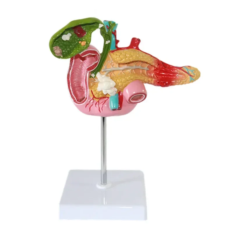 A Human Liver Model, Pancreatic Model, Duodenal Model, Gallbladder Pathological Model