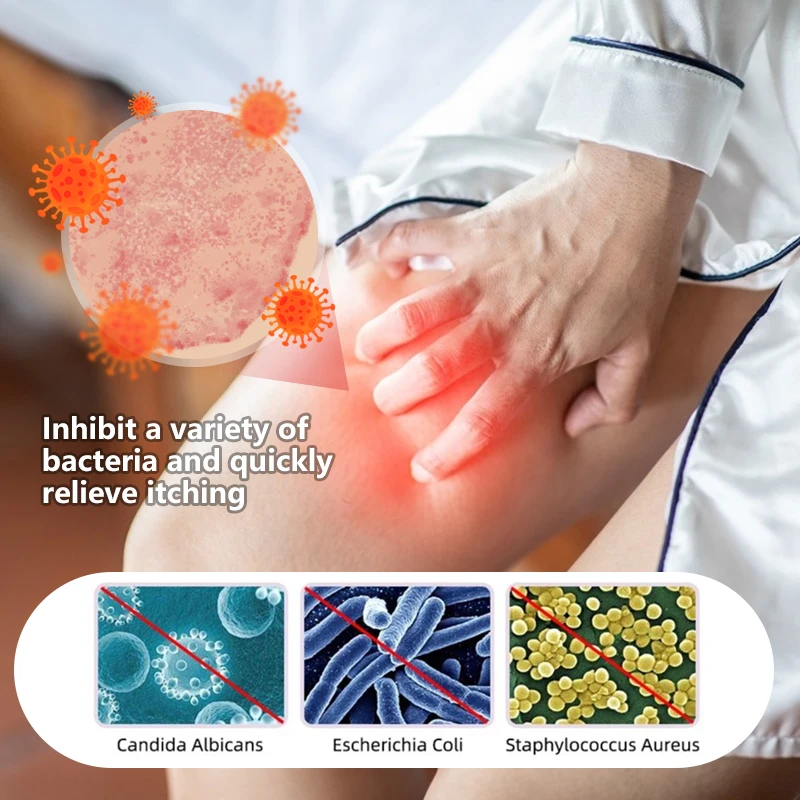 مضاد للجراثيم كريم الأكزيما مرهم إزالة رائحة الجزء الخاص التهاب الجلد المضادة للحكة Tinea Cruris عشب الجلد الطبي الصدفية كريم