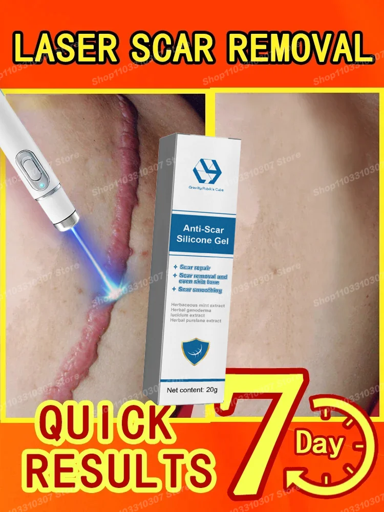 

new Laser therapy Keloid scar